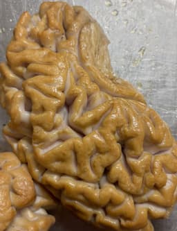 Cervello affumicato di vitello IQ70, pakchoi e salsa balsamica